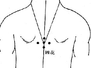 四花