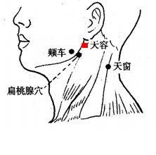 Tianrong