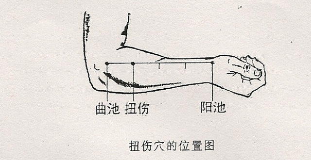 扭伤