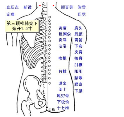 新设穴