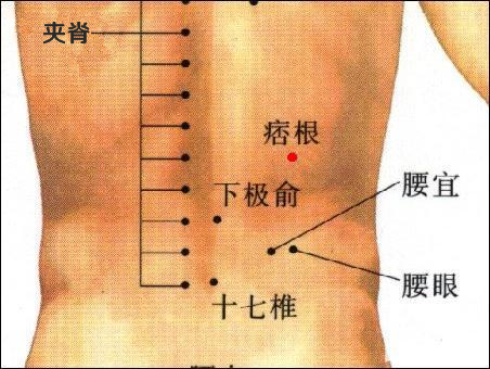 痞根