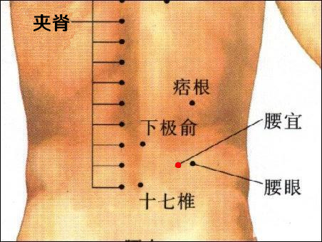 腰宜